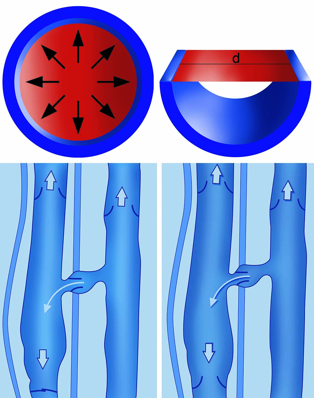 Phlebotherapy