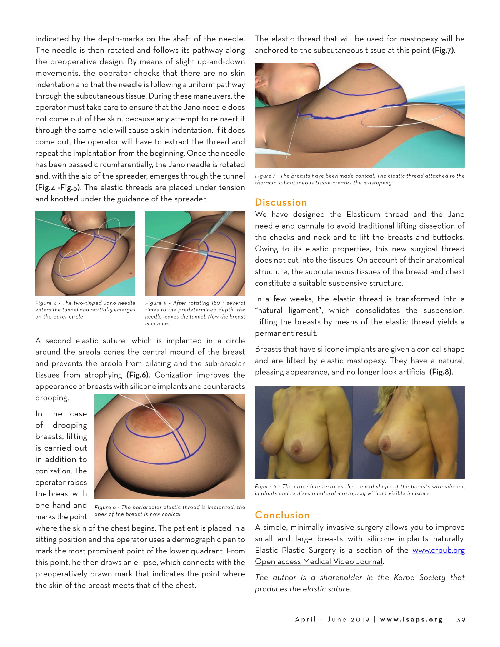 isaps news