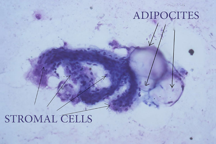 Stromal Cells