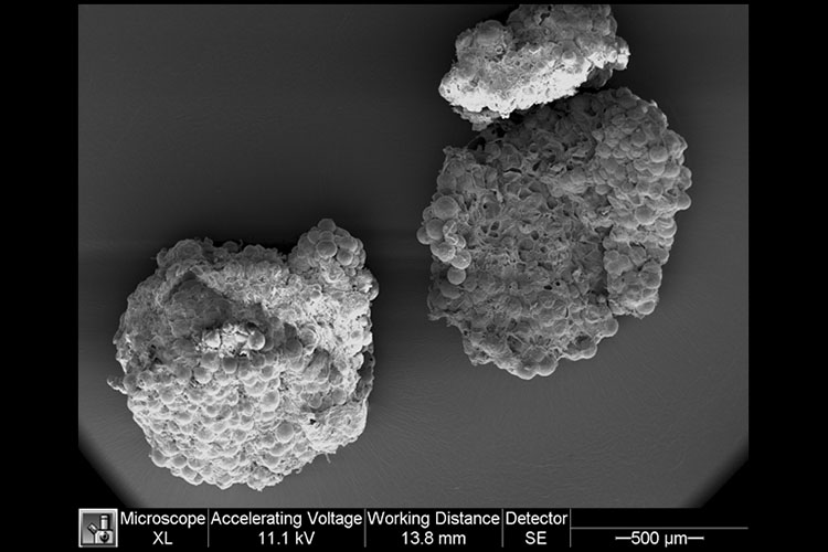 suspension of adipose and stromal cells